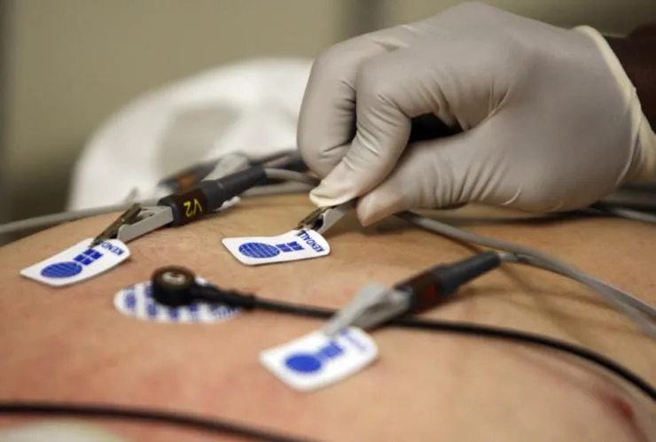 ECG electrodes being placed to monitor heart rhythm